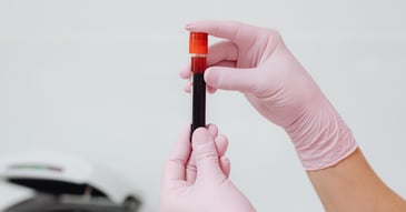 vial of blood for genetic testing for psychiatric medication management held in gloved hands